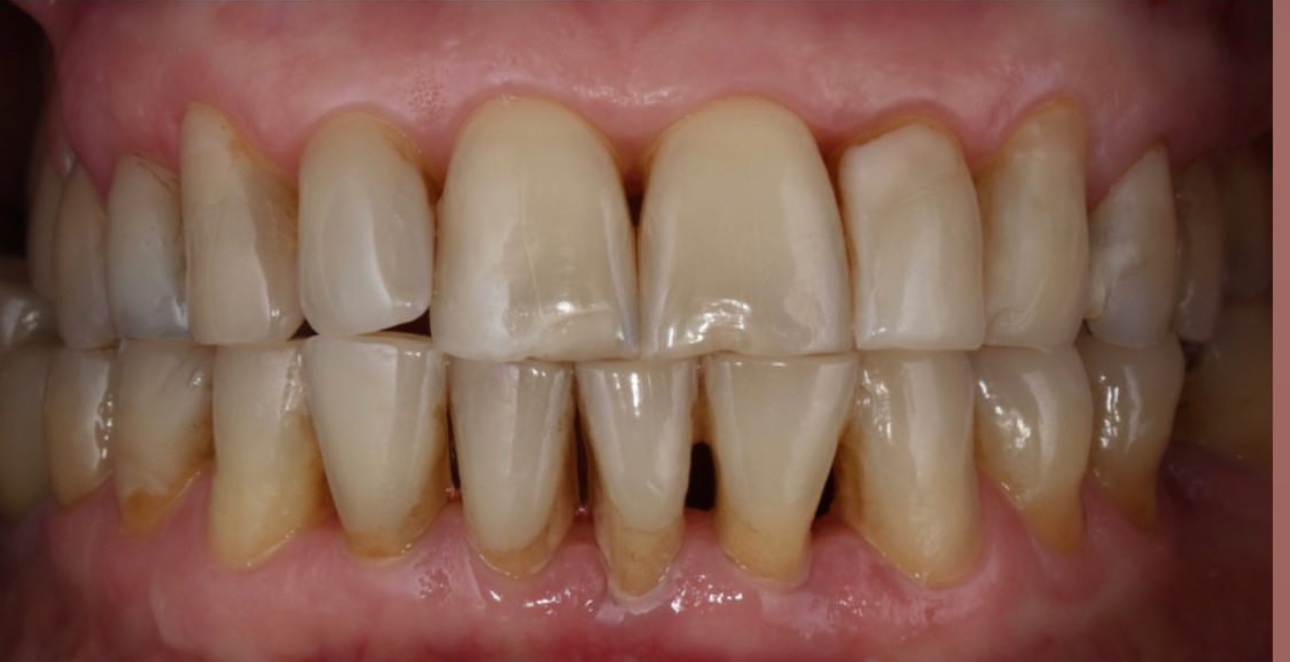 Antes e depois 2(1)